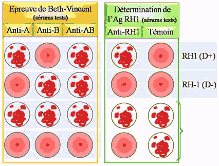 la détermination des groupes sanguins