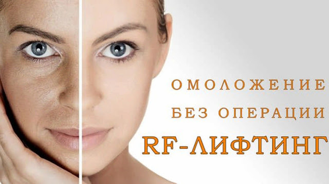 RF face lift, RF-лифтинг лица, лицо, процедуры красоты, уход за лицом, уход за телом, anti-age, 