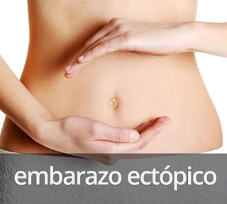 Embarazo ectópico