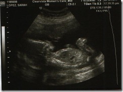 BabyUltrasound20Weeks1