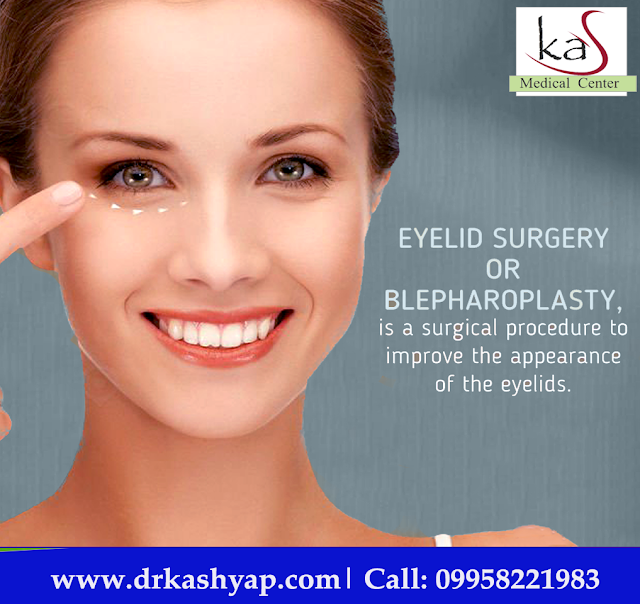 #eyelidsurgery #blepharoplastysurgeon #eyelidsurgerycost