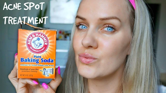 Baking Soda Mask Removes Acne