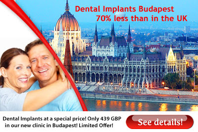 dental implants Budapest