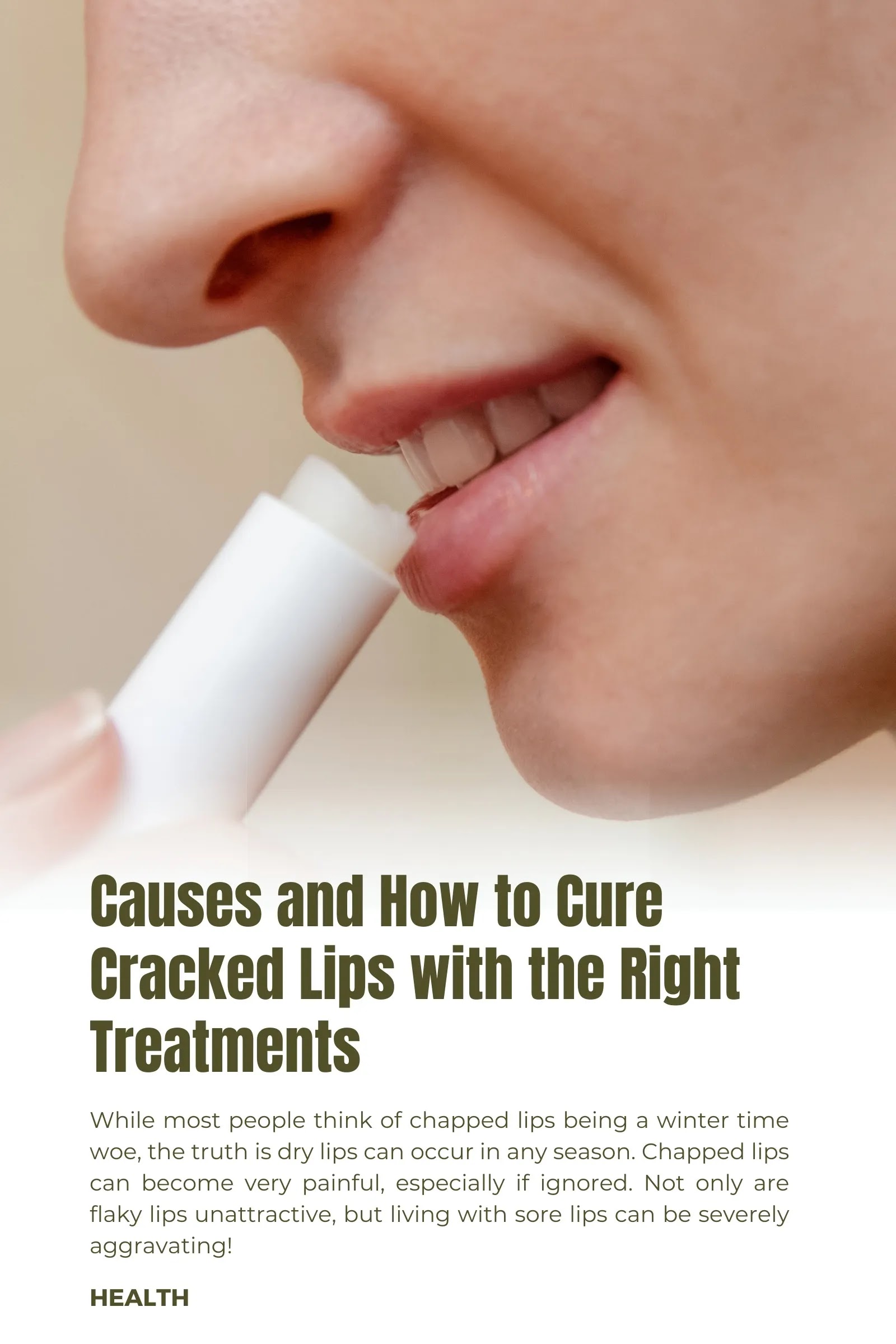 Causes and How to Cure Cracked Lips with the Right Treatments
