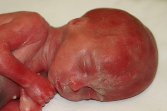 A Hardly 3 Inch Fetus Still Alive