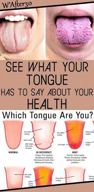 3 Things Your Tongue is Trying to Reveal About Your Health