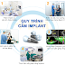  Cấy ghép implant tiêu chuẩn quốc tế là gì?