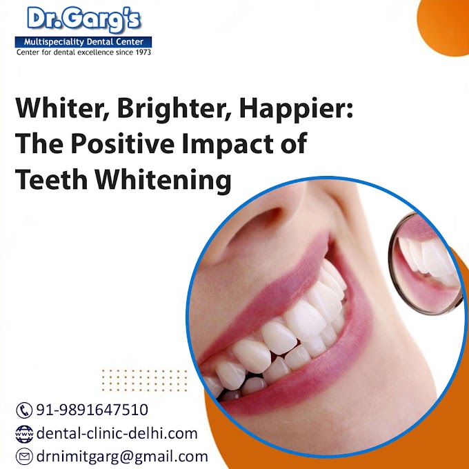 Whiter, Brighter, Happier: The Positive Impact of Teeth Whitening