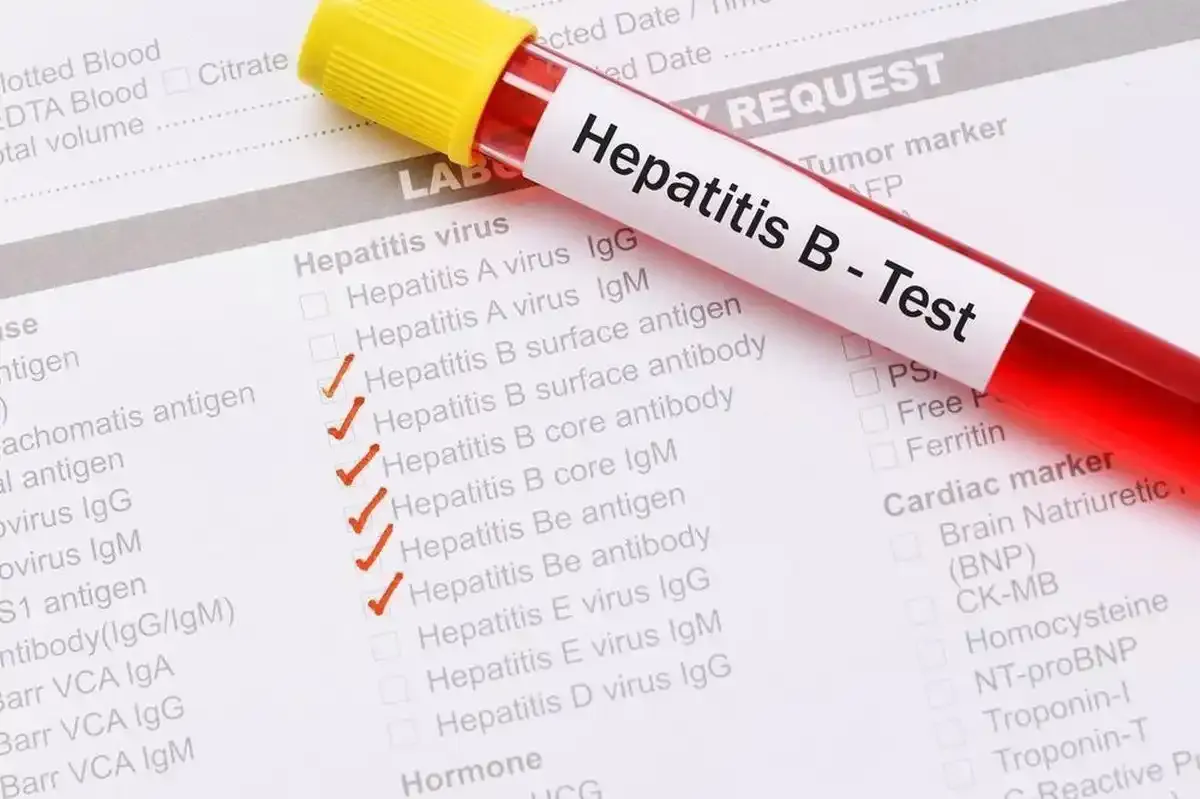 hepatitis B en Nueva York