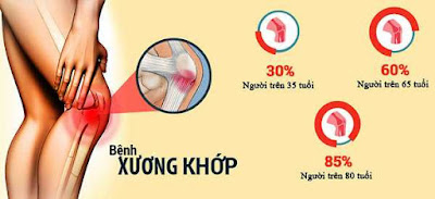 Căn bệnh đau nhức xương khớp