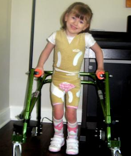 Baby Cerebral Palsy Pictures