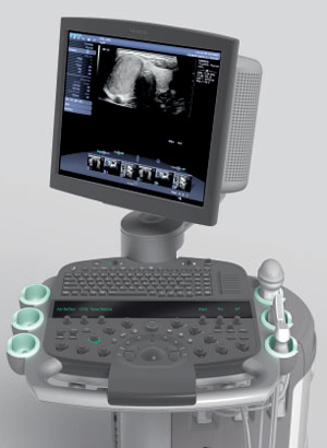 siemens  ultrasound