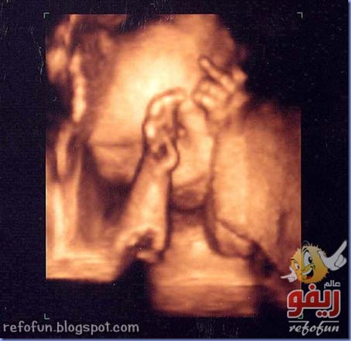 a97768_ultrasoundthefingerwww-refofun