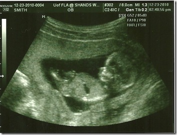 baby girl 2