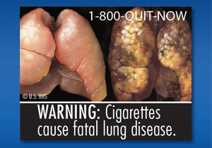 lung cancer symptoms for smokers Smoke cancer hand second secondhand
leading slideshare