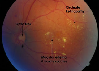 clinical experimental ophthalmology journal