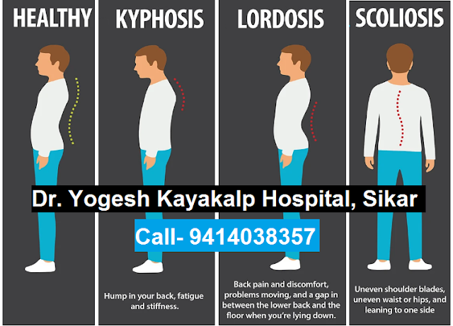 Spinal Deformities- Kyphosis, Scoliosis & Lordosis