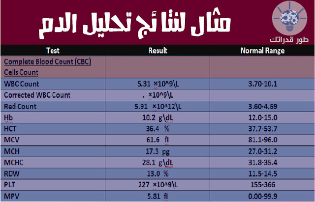 مثال لنتائج تحليل الدم