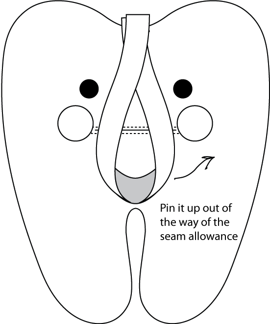 Consent: Glue stitch dental