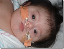 b4 surgery 002