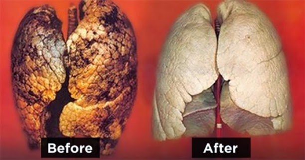 Clean-Your-Lungs-From-Smoking