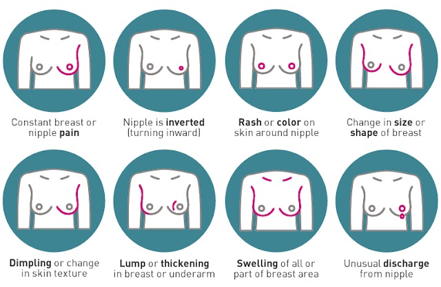 Breast cancer Types, its Symptoms, causes, and how to prevent breast cancer