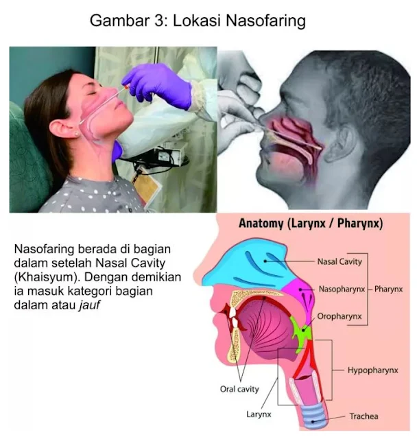 Tes Swab Apakah Membatalkan Puasa?