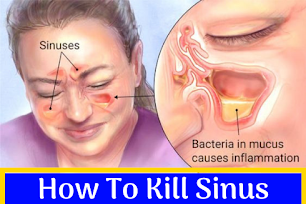 How To Kill Sinus Infections In Just 2 Minutes With Hydrogen Peroxide And Sea Salt