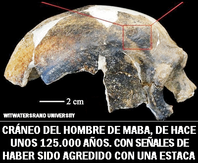 craneo golpe