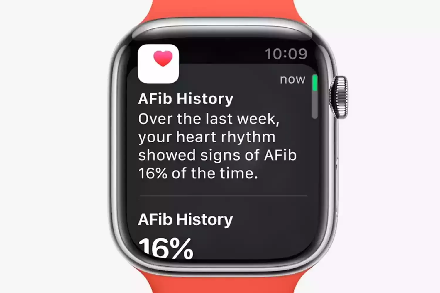 Apple Watch watchOS 9 "Atrial Fibrillation History" Feature