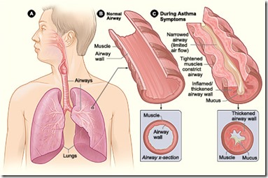asthma-info