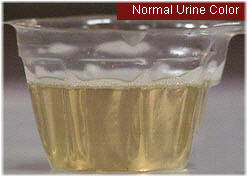 Urine color