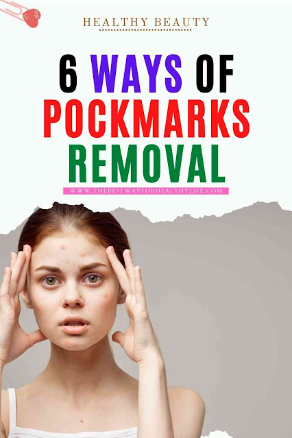 picture pockmarks removal