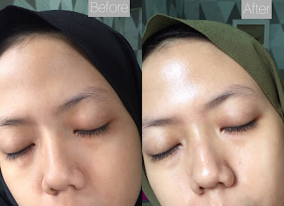 result pemakaian skincare dewpre