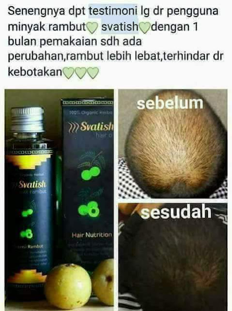 Perawatan Rambut (SVATISH HAIR NUTRITION dari VARASH)