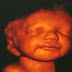 Ibu ini batal aborsi sebab bayinya tersenyum saat USG