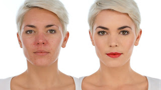 Makeup Fоr Rosacea