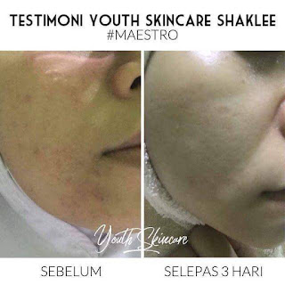 Youth skincare, twb, kursus spa murah, kursus mobile spa, ee beauty spa, spa murah