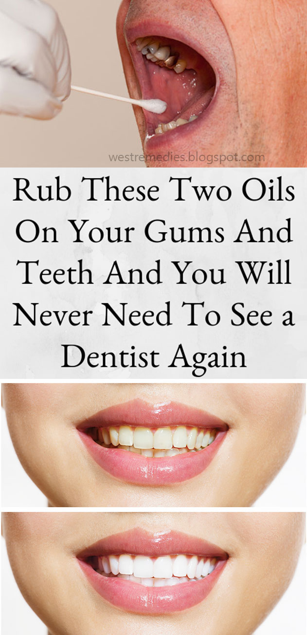 TRY RUBBING THESE TWO OILS ON YOUR GUMS AND TEETH AND YOU WILL NEVER NEED TO SEE A DENTIST AGAIN
