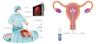 infertility centre in lucknow