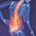 Bệnh đau lưng nguyên nhân do đâu?
