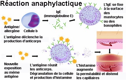 allergie mécanisme physiopathologie infirmier