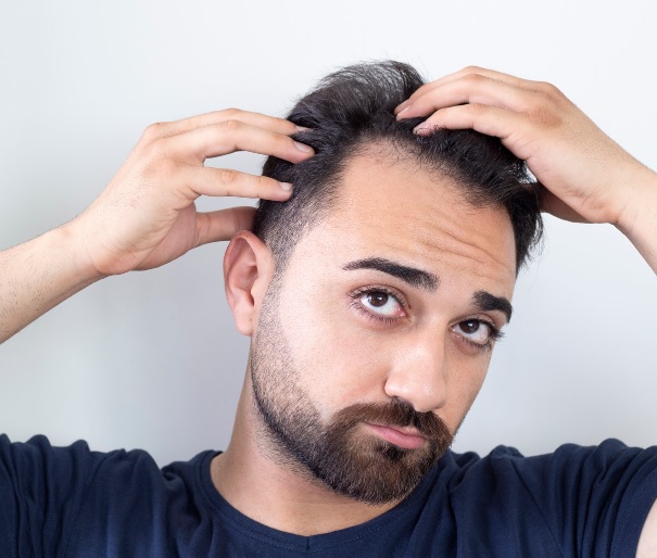 tips to stop hair loss