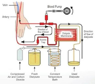 Prinsip Kerja Hemodialisa