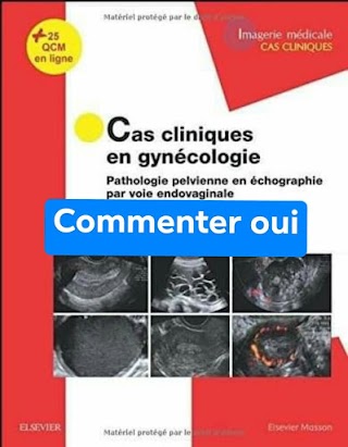 Cas cliniques en gynécologie" Pathologie pelvienne en échographie par voie endovaginale"