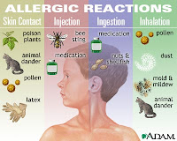 Allergic Reactions To Injection, Ingestion, Skin Contact, And Inhalation