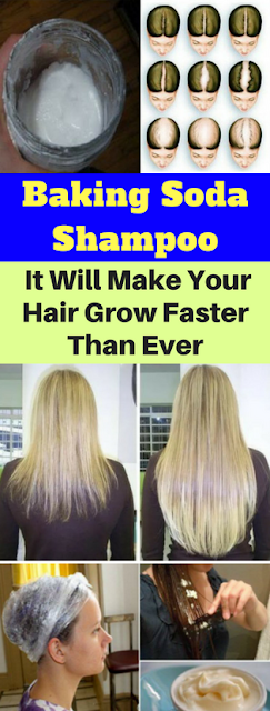 Baking Soda Shampoo: It Will Make Your Hair Grow Faster Than Ever