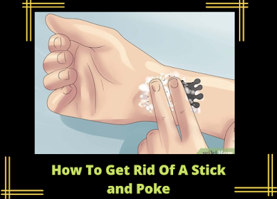 How To Get Rid Of A Stick and Poke