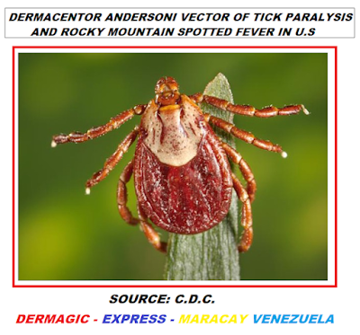 Dermacentor Andersoni tick, one of the vectors of Tick Paralysis in the USA.