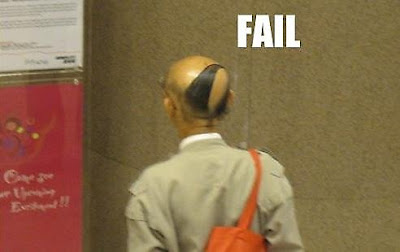bald men hairstyle